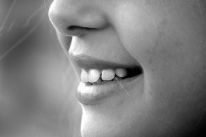 wybielanie zębów - jak dbać o zęby po wybielaniu?